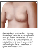 Gynecomastia