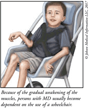 Patient Teaching Aid: Muscular Dystrophy